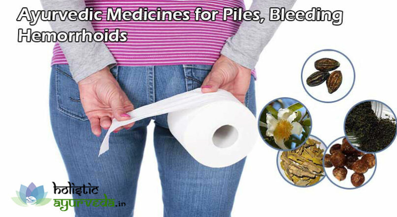 Ayurvedic Medicines for Piles