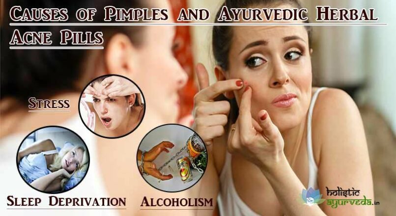 Causes of Pimples and Ayurvedic Herbal Acne Pills