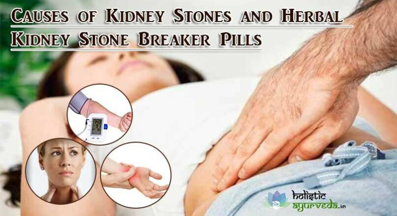 Causes of Kidney Stones and Herbal Kidney Stone Breaker Pills