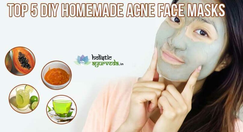 Homemade Acne Face Masks Recipes