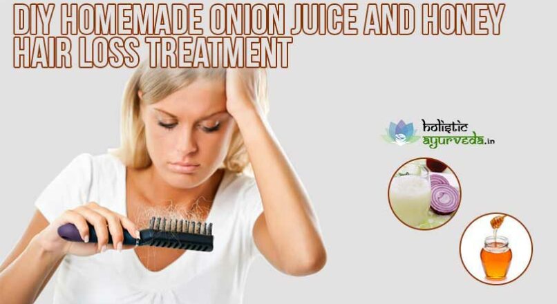 Homemade Onion Juice and Honey Hair Loss Treatment