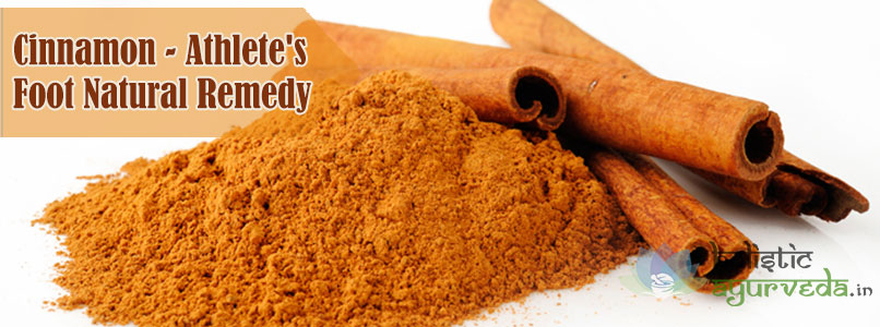 Cinnamon Athlete's Foot Natural Remedy