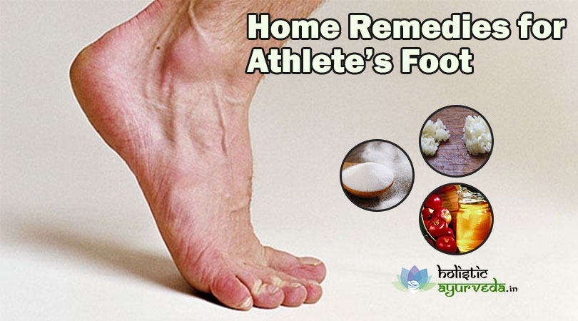 9 home remedies for athlete s foot cure with 9 home remedies for athlete s foot cure with